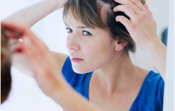 PRP for hair growth