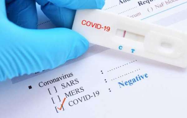 How to take the Covid Test at Home