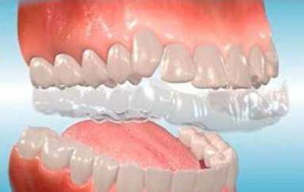 Clear Orthodontics