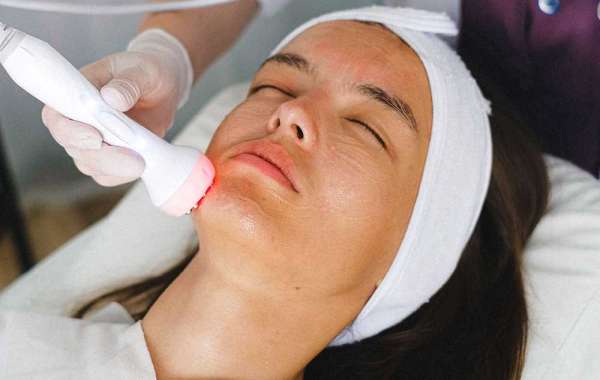 Laser Treatment For Skin Pigmentation & Hyperpigmentation