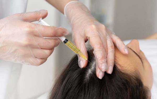 Hair Loss Treatment in Waterloo