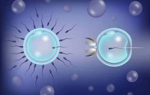 The Ins and Outs of IVF Treatment in Ahmedabad