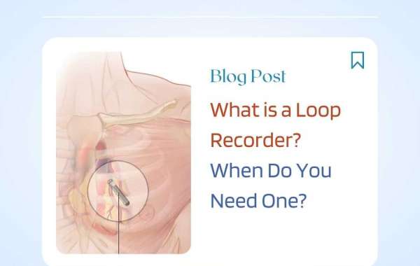 What Is Loop Recorder
