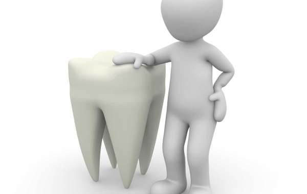 Dental Crowns in Macclesfield: Restoring Your Smile's Strength and Beauty