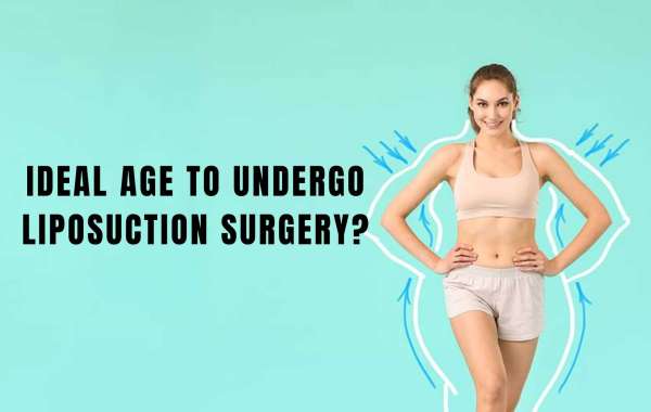 Ideal Age To Undergo Liposuction Surgery?
