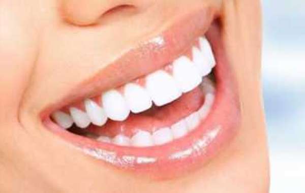 5 Reasons for Getting a Smile Makeover