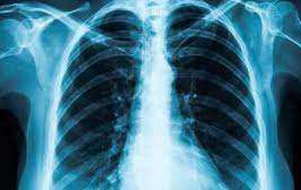 X-ray Market, Size, Share, Top Region, Key Players, Application, Status And Forecast Till 2027
