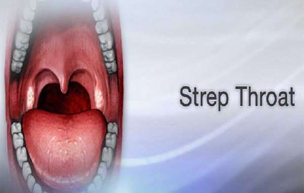 Living with Strep Throat Without Tonsils: A Guide