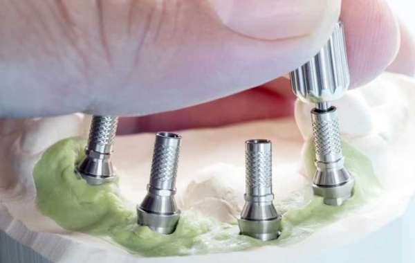 The All-on-Four Dental Implant Solution for Denture Wearers