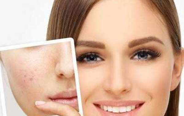 Effective Acne Scar Treatment: Strategies to Rejuvenate Your Skin