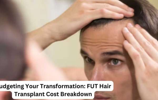 Budgeting Your Transformation: FUT Hair Transplant Cost Breakdown