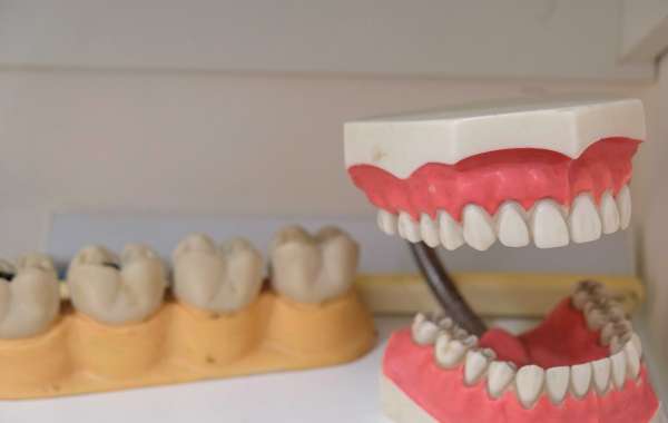 Implant Dentistry Excellence in Manchester