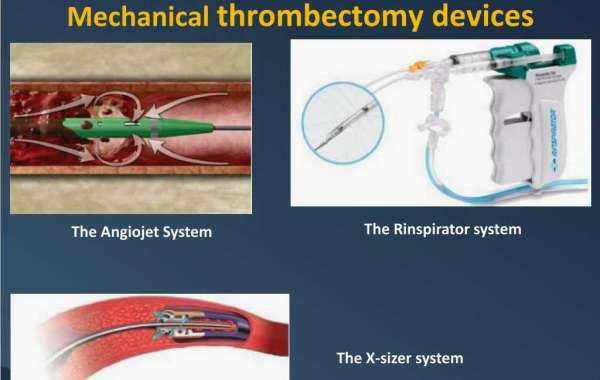 Mechanical Thrombectomy Devices Market to Advance at CAGR of 6.4% during 2023-2031: TMR Study