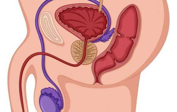 Connecting the Dots: Bladder and Bowel Issues as Symptoms of Enlarged Prostate