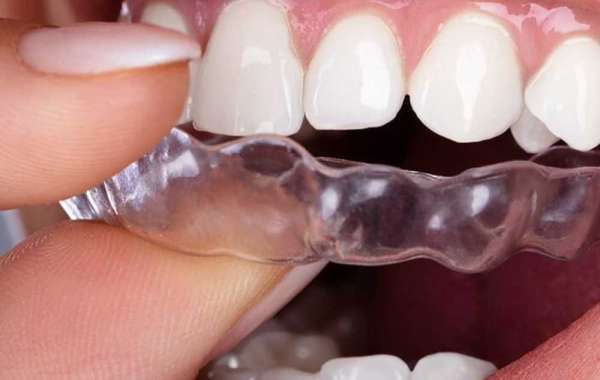 Invisalign Braces vs. Traditional Braces: Which Is Right for You?