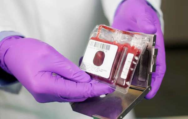 Cord Blood Banking Services Market to Reach US$ 64.7 Mn by 2027, observes TMR Study