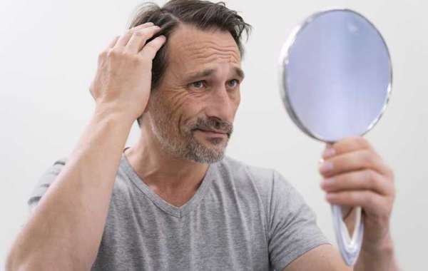 Hair Transplant Cost in Lahore and Pakistan Cosmeticoplasty