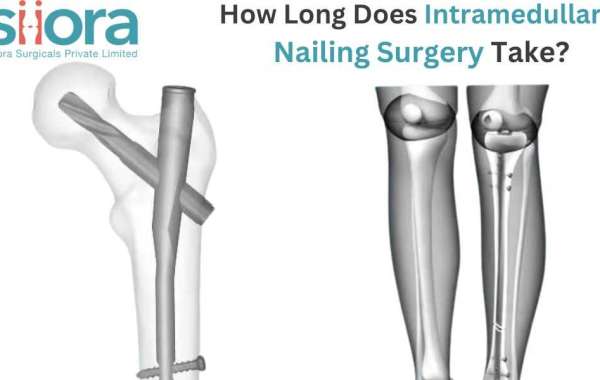 How Long Does Intramedullary Nailing Surgery Take?