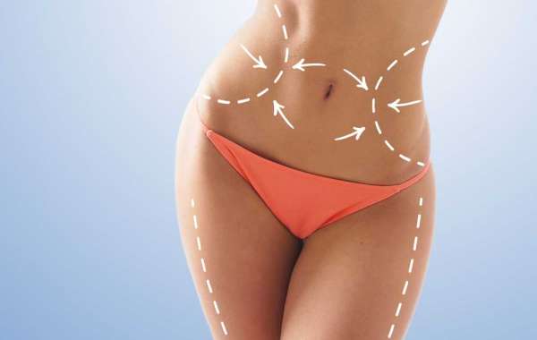 Post-Operative Care Tips for a Successful Tummy Tuck Recovery