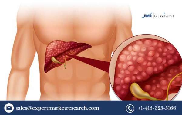 North America Tumor Ablation Market Analysis, Industry Trends and Forecast - 2034